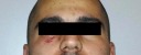 Arancia meccanica a Pianella: arrestato aggressore fuggito dai domiciliari