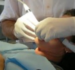 Allarme falsi dentisti, in Italia una denuncia al giorno