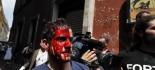 Uno dei manifestanti feriti