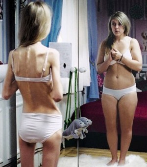 I media complici del disturbo alimentare?