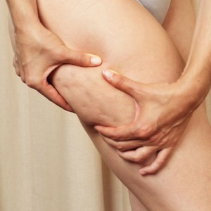 Rivoluzionaria scoperta sull'origine della cellulite: conoscerla per combatterla