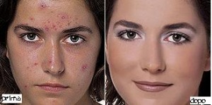 I fondotinta coprenti: quando è possibile, meglio evitare
