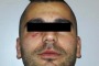 Arancia meccanica a Pianella: arrestato aggressore fuggito dai domiciliari