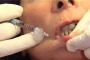 Medicina estetica, al sud impazza peeling, al nord il botox
