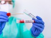 Covid | in Abruzzo 101 nuovi positivi e 81 guariti - Vimarsana News