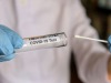 Covid, ieri in Abruzzo registrati altri 5 decessi e per il virus, 1135 i nuovi positivi Covid, ieri in Abruzzo registrati altri 5 decessi e per il virus, 1135 i nuovi positivi