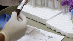 Ricerca, virus Zika