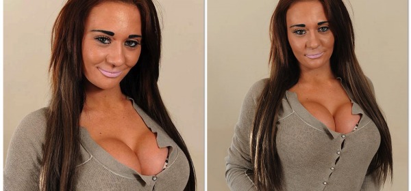 Josie Cunningham con il seno nuovo