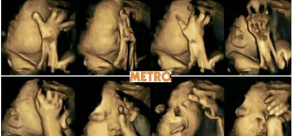 Il feto di una madre fumatrice (Metro)