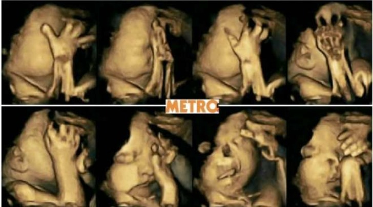 Il feto di una madre fumatrice (Metro)